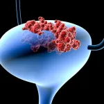 埃塞俄比亚提格雷地区濒临新一轮冲突