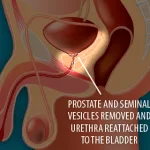 中国不锈钢可重复使用火箭“朱雀三号”完成最后主要地面试验
